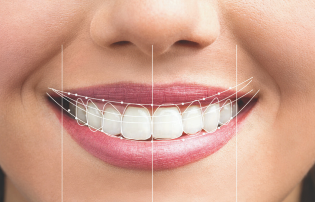 Smile Design in Istanbul | Best Price, Best Quality | Start 2,990 TL