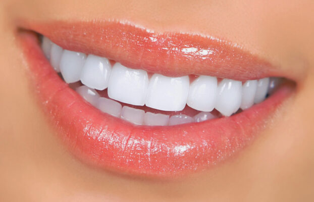 Veneers in Turkey | Best Quality , Best Price | 4,490TL