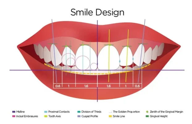 Smile Design Turkey Price Start 2,990 TL | Best Price, Best Quality