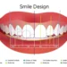 Smile Design Cost in Istanbul 2024