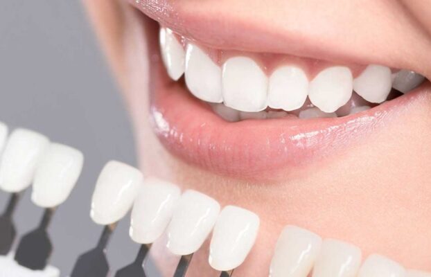 Dental Veneers in Istanbul | Best Quality , Best Price | 4,490TL